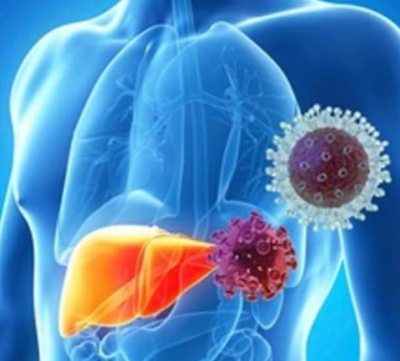 В России проходит неделя профилактики заболеваний печени