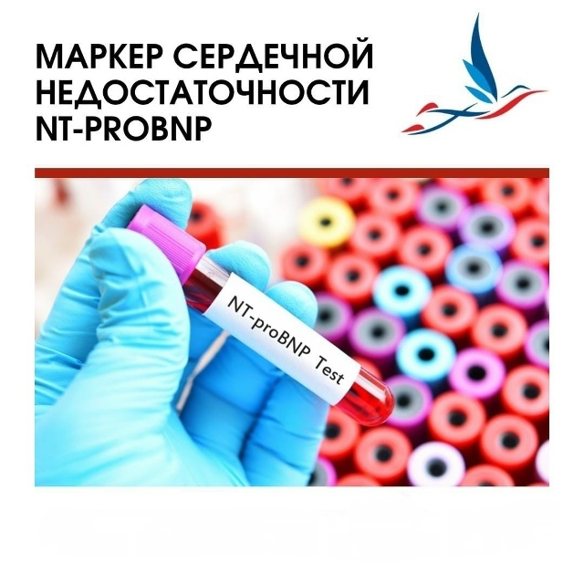 Пройдите исследование маркера сердечной недостаточности в ОККД